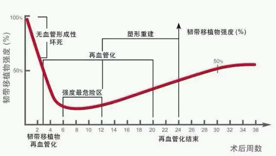 前交叉韧带重建时间与强度图