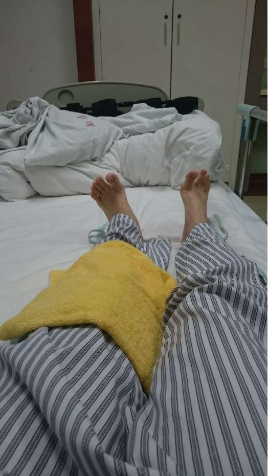 【叉友投稿】ACL术后心得——18岁生日前几天断叉