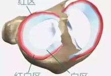 谁看谁想赞!半月板再生手术,日本已开始临床实验-前叉之家