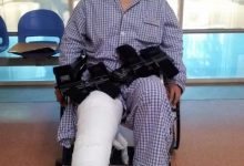 迟来十二年的手术「继续者张付」的膝伤术后百日纪-前叉之家