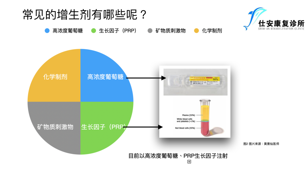 增⽣疗法在前交叉韧带损伤康复中的运⽤ - 常见的增生剂都有哪些呢