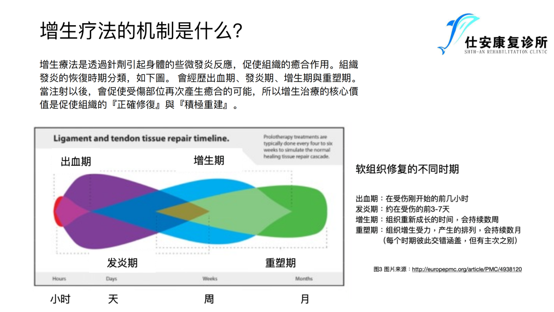 增⽣疗法在前交叉韧带损伤康复中的运⽤ - 增生疗法的机制是什么