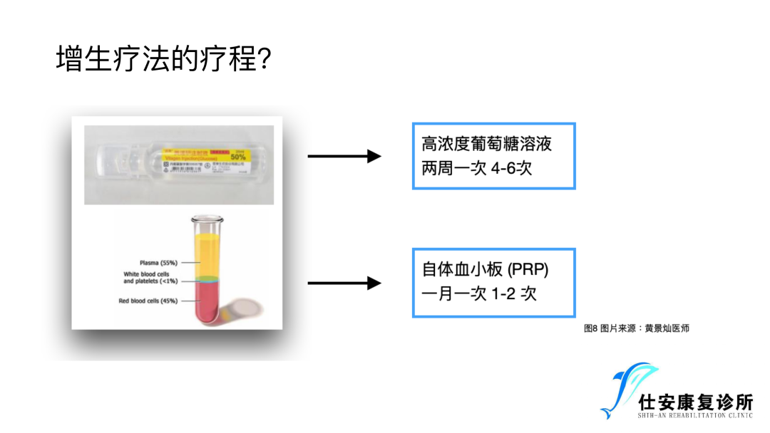 增⽣疗法在前交叉韧带损伤康复中的运⽤ - 增生疗法治疗前交叉韧带损伤的疗程