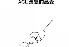 前交叉韧带重建术后,1600元福利,送给江浙沪叉友-前叉之家