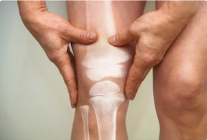 前交叉韧带和后交叉韧带有哪些区别 前叉之家