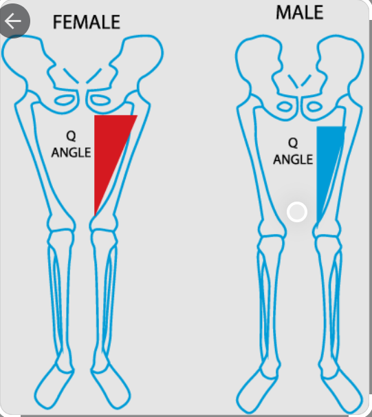 女性是前交叉韧带断裂损伤的高危群体 南京复见运动医学康复诊所