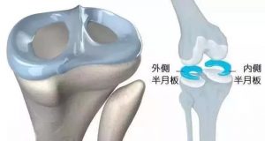 前叉术后暴走可以导致半月板损伤和髌骨软化吗？-前叉之家