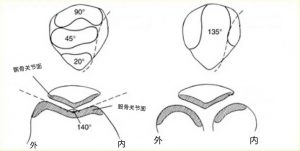 前交叉韧带重建角度下不去什么原因-前叉之家