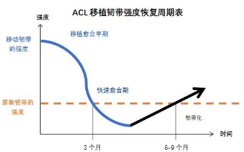 前交叉韧带重建术后重返运动一定不能忽略的问题 - 时间