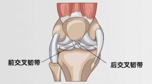 前交叉韧带重建术后松弛如何预防？-前叉之家