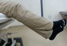 韧带重建4个月没力量正常吗?-前叉之家