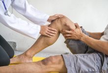 前交叉韧带术后康复“困难户”拄着双拐异地康复之路…-前叉之家