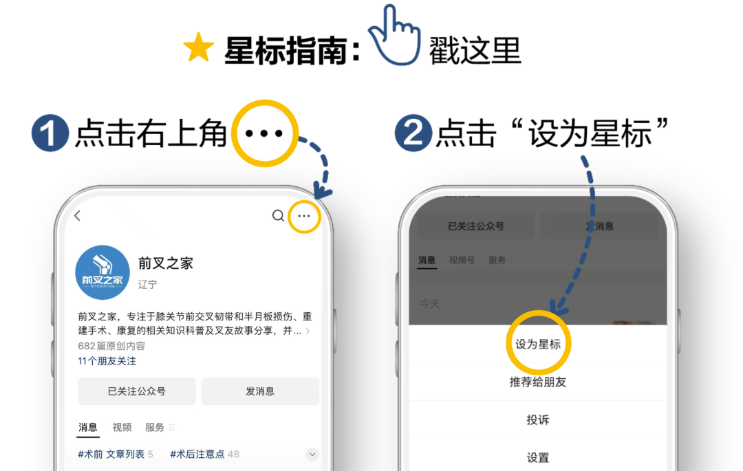前叉术后只练腿？90%的叉友忽略了这个盲区，难怪膝盖反复疼痛-前叉之家