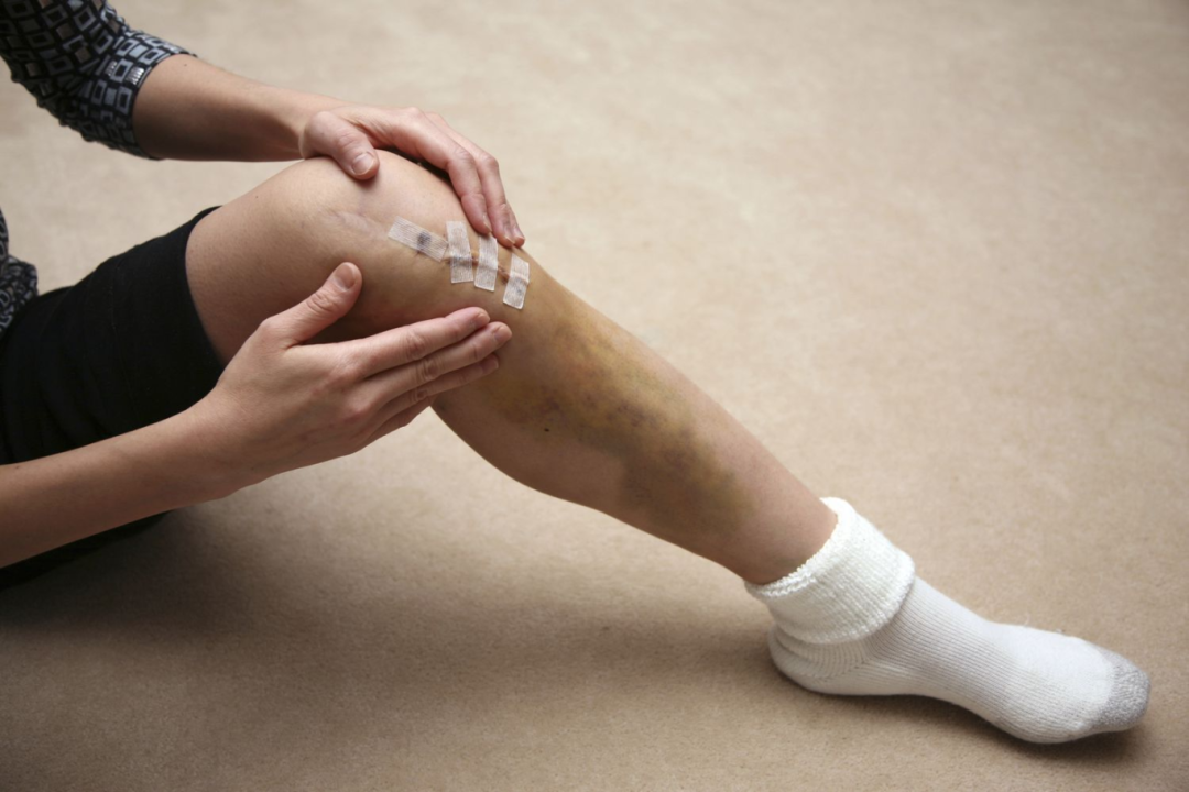 Risks of ACL Surgery and Ligament Reconstruction
