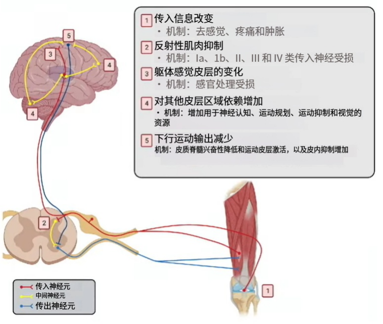 二断那一刻,终于明白原装前叉和重建韧带的区别-前叉之家