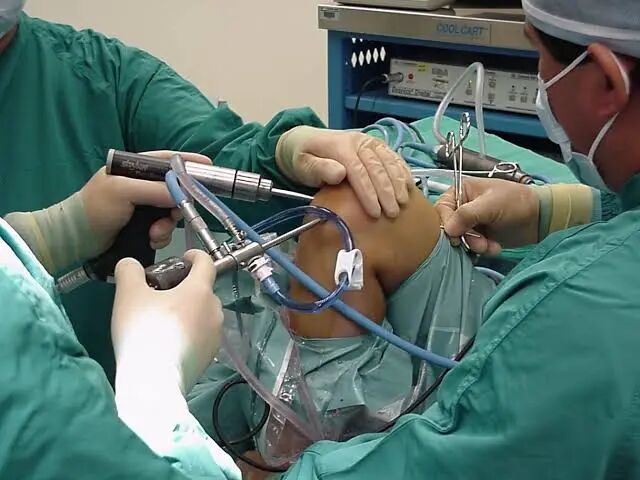 ACL Surgery – Sportsmed Mumbai