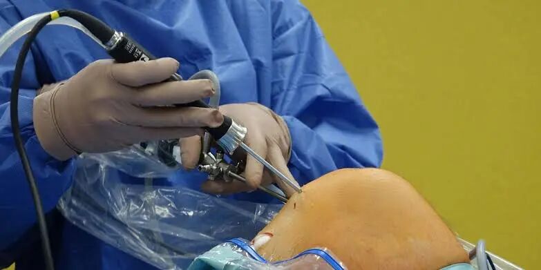 Understanding ACL Surgery: Complete Guide & Recovery Tips